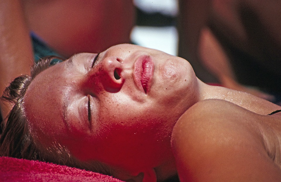 woman face SUNBURN under sun